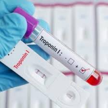 تصویر 1 از کیت تشخیص سریع سکته ی قلبی cTnI + قیمت مناسب خرید به صرفه